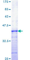 12.5% SDS-PAGE Stained with Coomassie Blue.